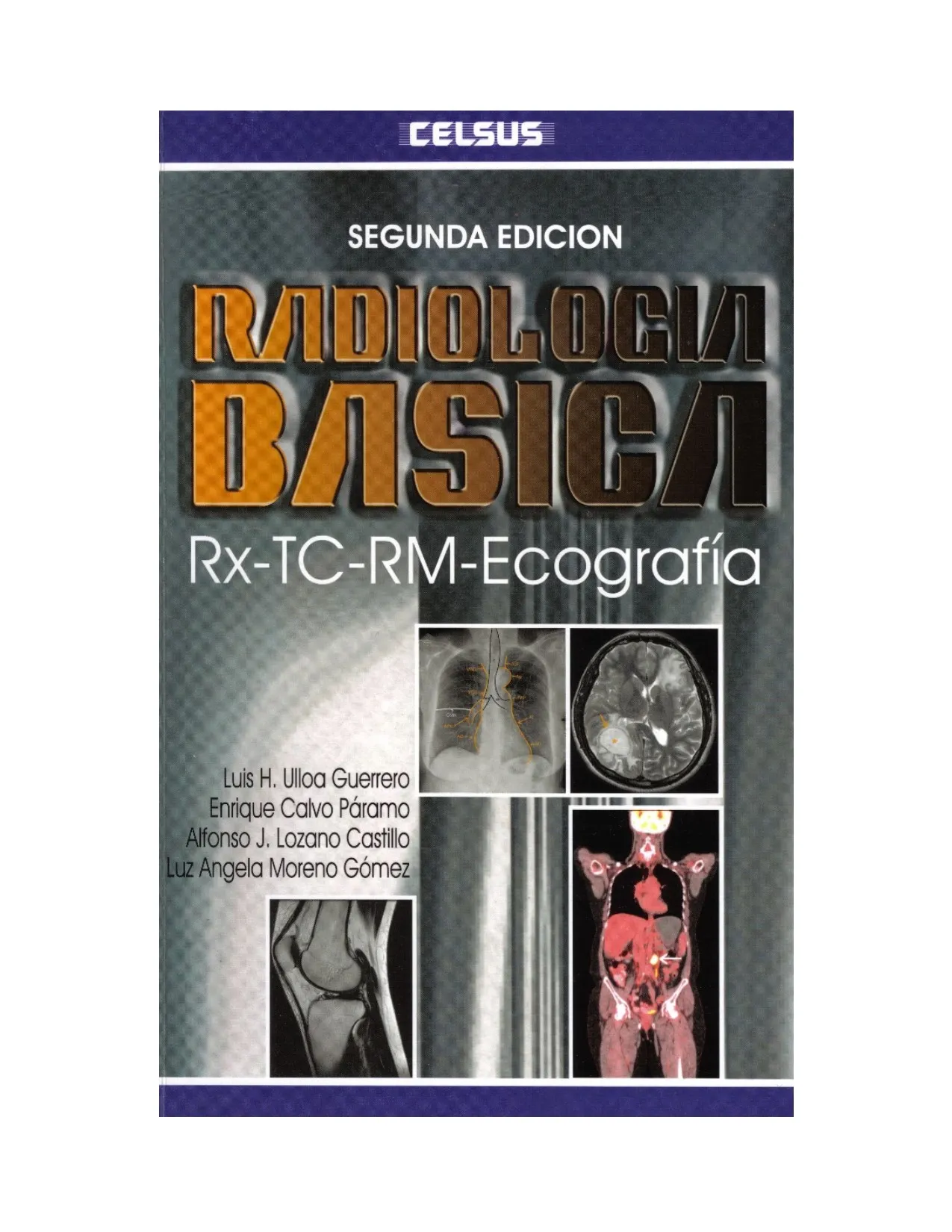 Radiologia Basica