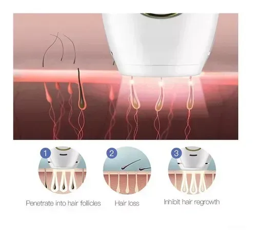 Depilador Láser Ipl Permanente