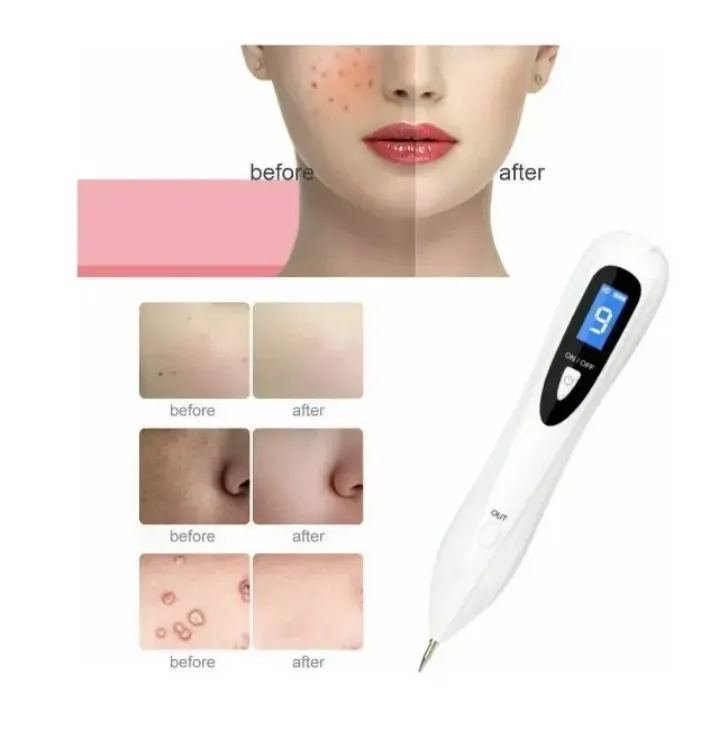 Cauterizador Electrico Quita Pecas/ Manchas Laser Recargable