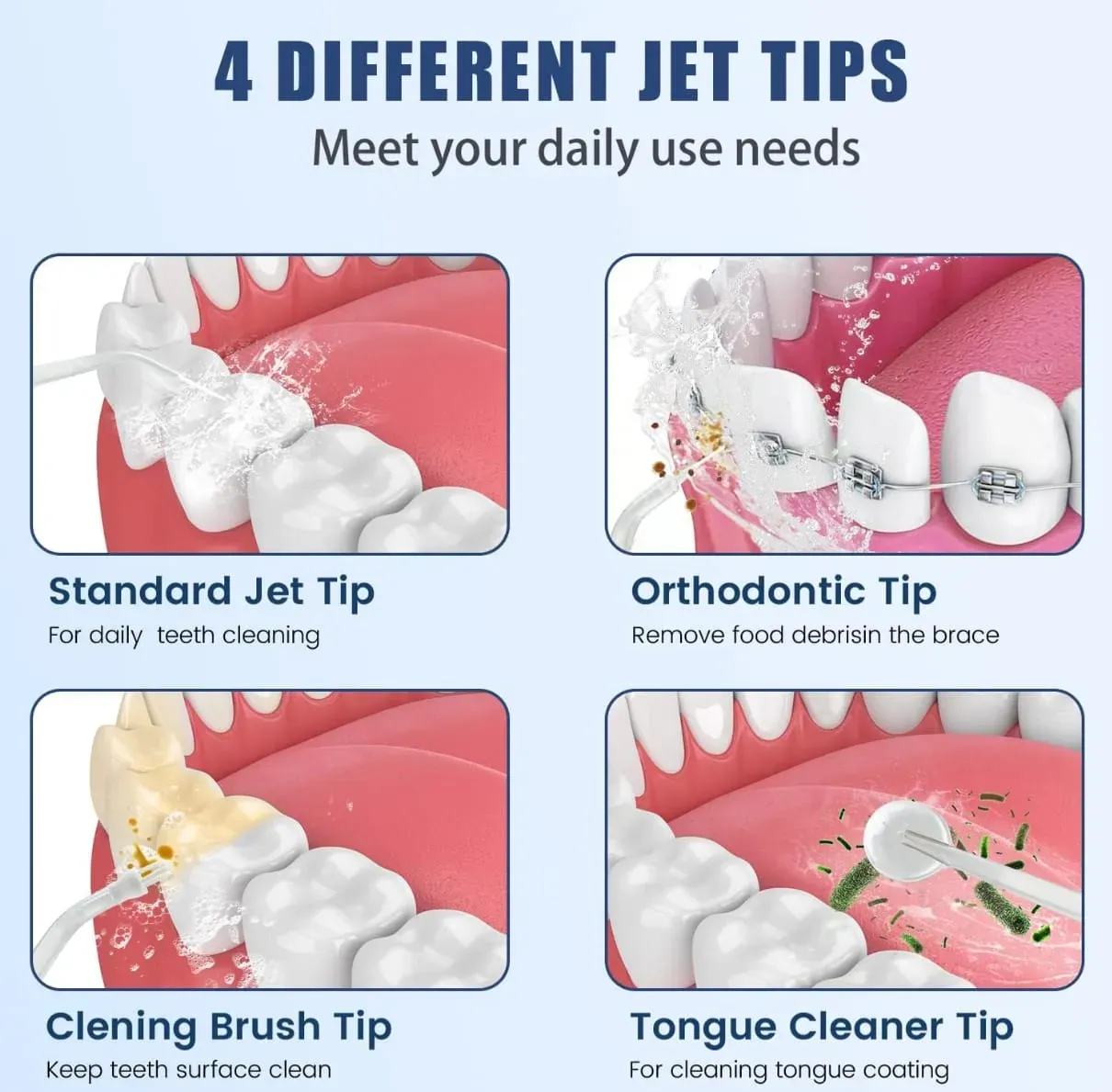 Irrigador Dental De Agua Inalámbrico Portátil Con 4 Puntas De Chorro, 3 Modos De Limpiador De Dientes Recargable Para Viajes