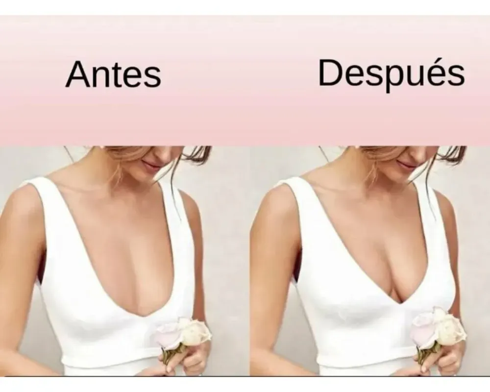 Cinta Adhesiva Para Levantamiento De Senos Boob Tape