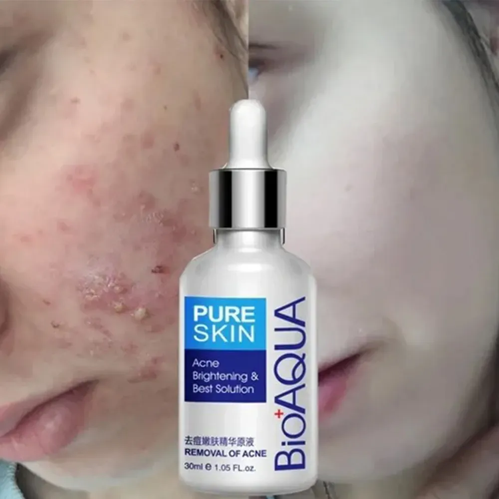 Serum Antiacné Para Pieles Grasas de Bioaqua