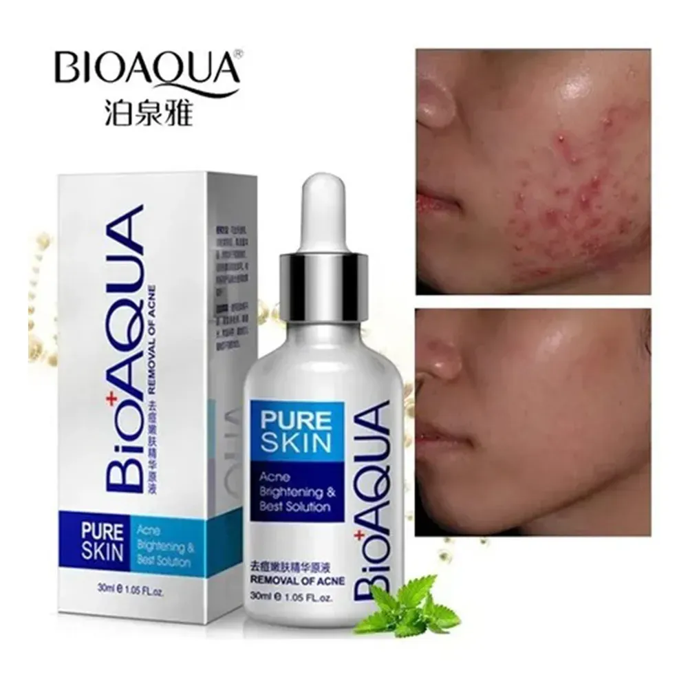 Serum Antiacné Para Pieles Grasas de Bioaqua