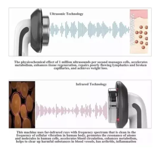 Ultrasonido Infrarrojo 3 En 1 Portátil Masaje Cavitación Color Blanco 110V