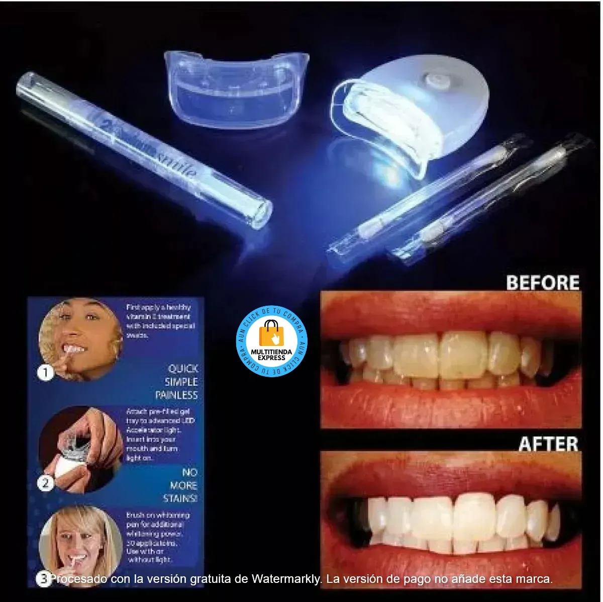 Kit de Blanqueamiento Dental