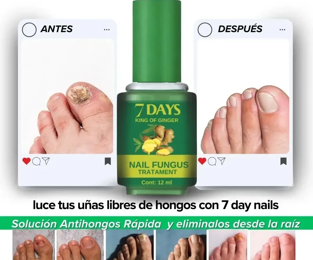 Esmalte 7 Days Uñas antihongos