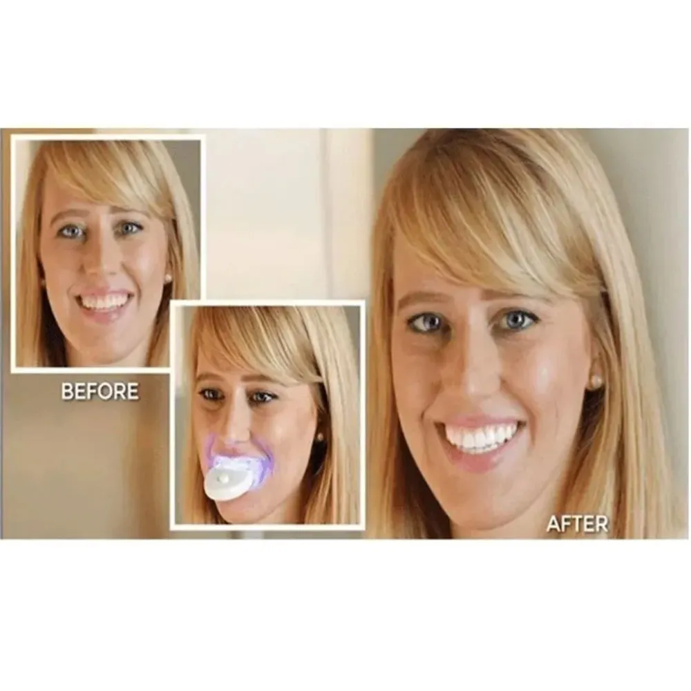 Limpiador Blanqueador Dental 20 Minutos Luz Led Blanco