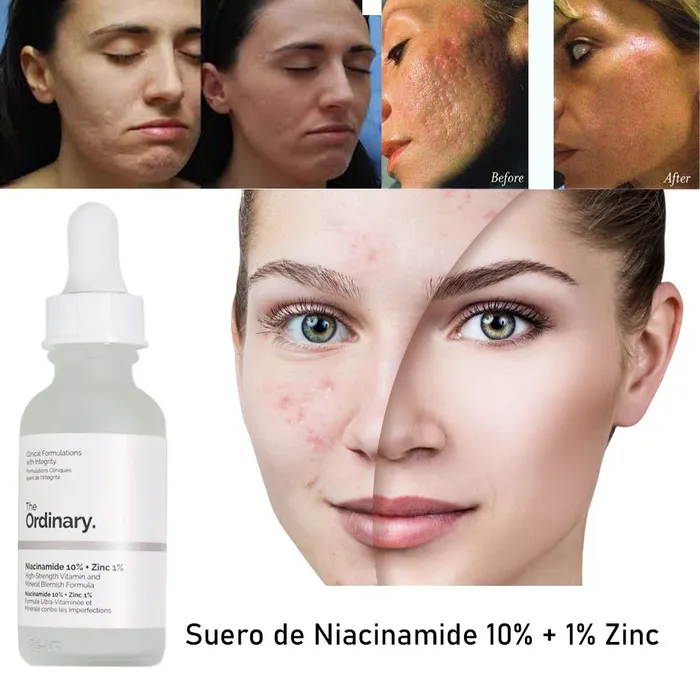 Sérum Niacinamida 10% + Zinc 1% The Ordinary día/noche para todo tipo de piel de 30mL +15 años